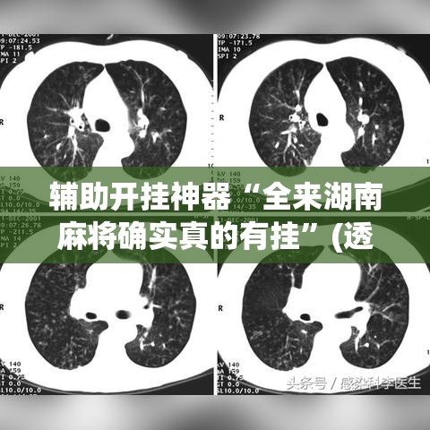 必备科技“途游四川麻将小程序有挂吗”透视开挂辅助教程